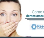 DENTES AMARELARAM? PORQUE? COMO EVITAR?